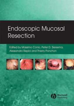 Conio, Massimo - Endoscopic Mucosal Resection, ebook