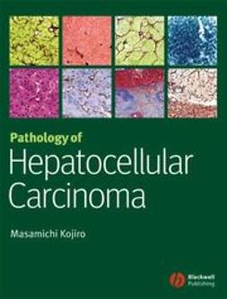Kojiro, Masamichi - Pathology of Hepatocellular Carcinoma, ebook