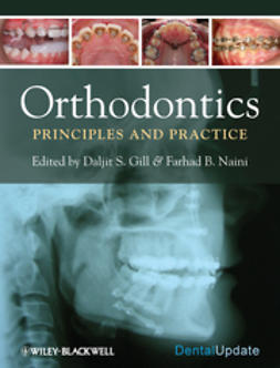 Gill, Daljit - Orthodontics: Principles and Practice, ebook