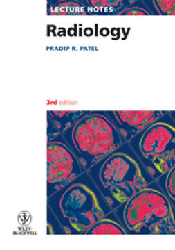 Patel, Pradip R. - Lecture Notes: Radiology, e-bok