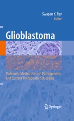 Ray, Swapan K. - Glioblastoma:, ebook