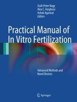 Nagy, Zsolt Peter - Practical Manual of In Vitro Fertilization, e-kirja