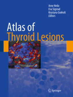 Heilo, Arne - Atlas of Thyroid Lesions, ebook