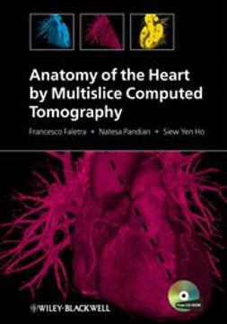 Faletra, Francesco - Anatomy of the Heart by Multislice Computed Tomography, e-bok