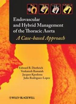 Diethrich, Edward B. - Endovascular and Hybrid Management of the Thoracic Aorta: A Case-based Approach, e-bok