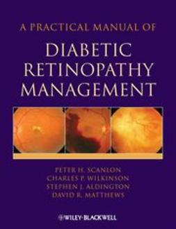 Scanlon, Peter - A Practical Manual of Diabetic Retinopathy Management, e-kirja