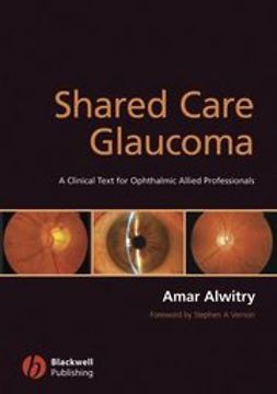 Alwitry, Amar - Shared Care Glaucoma, ebook