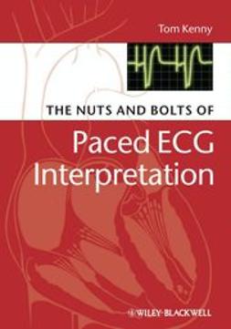 Kenny, Tom - The Nuts and bolts of Paced ECG Interpretation, ebook