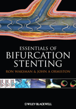 Waksman, Ron - Essentials of Bifurcation Stenting, ebook