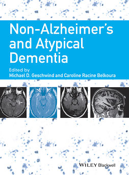 Belkoura, Caroline Racine - Non-Alzheimer's and Atypical Dementia, ebook