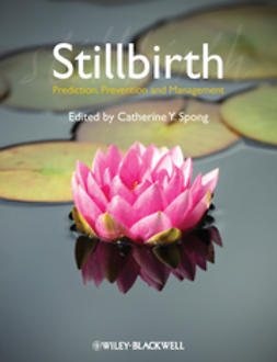 Spong, Catherine Y. - Stillbirth: Prediction, Prevention and Management, ebook
