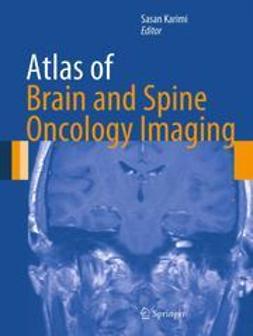 Karimi, Sasan - Atlas of Brain and Spine Oncology Imaging, e-kirja