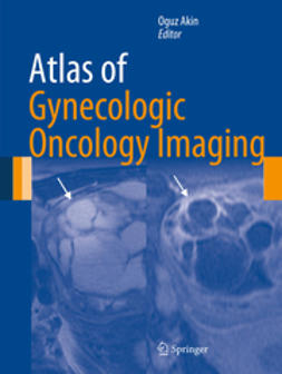 Akin, Oguz - Atlas of Gynecologic Oncology Imaging, ebook