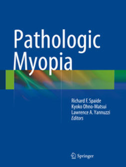 Spaide, Richard F. - Pathologic Myopia, ebook