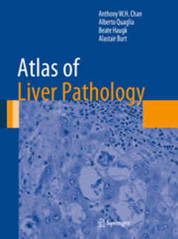 Chan, Anthony W.H. - Atlas of Liver Pathology, e-bok