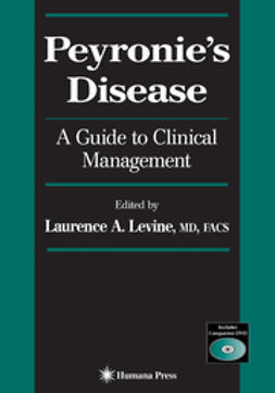 Levine, Laurence A. - Peyronie’S Disease, ebook