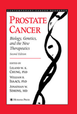 Chung, Leland W. K. - Prostate Cancer, ebook