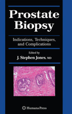 Jones, J. Stephen - Prostate Biopsy, e-kirja
