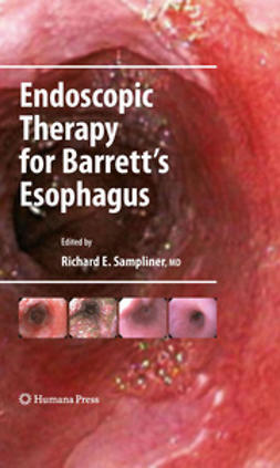 Sampliner, Richard E. - Endoscopic Therapy for Barrett's Esophagus, e-kirja