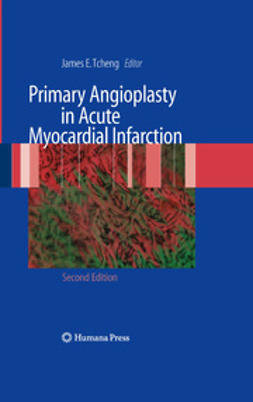Tcheng, James E. - Primary Angioplasty in Acute Myocardial Infarction, e-kirja