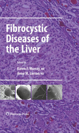 Murray, Karen F. - Fibrocystic Diseases of the Liver, e-kirja
