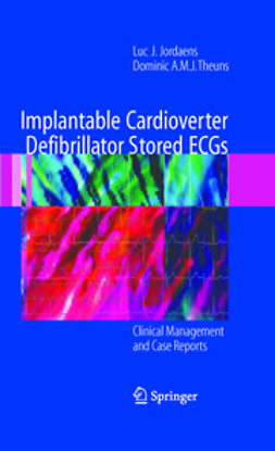 Jordaens, Luc J. - Implantable Cardioverter Defibrillator Stored ECGs, e-bok