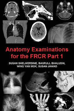 Shelmerdine, Susan - Anatomy Examinations for the FRCR Part 1, ebook