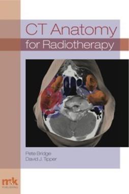 Bridge, Peter - CT Anatomy for Radiotherapy, e-kirja