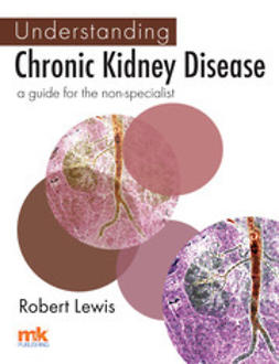 Lewis, Robert - Understanding Chronic Kidney Disease: A guide for the non-specialist, e-kirja