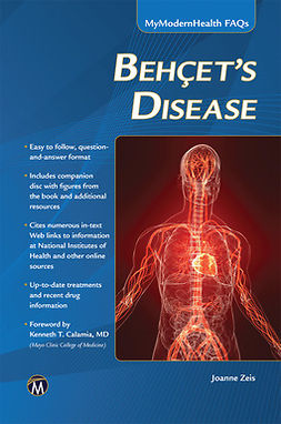 Zeis, Joanne - Behcet’s Disease, e-kirja
