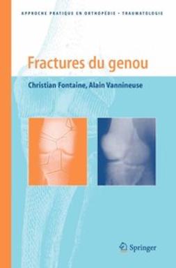 Fontaine, Christian - Fractures du genou, e-bok