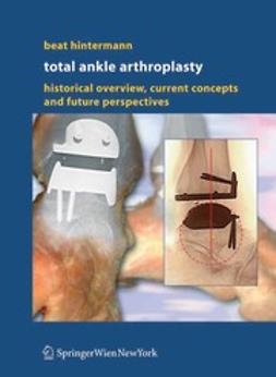 Hintermann, Beat - Total Ankle Arthroplasty, ebook