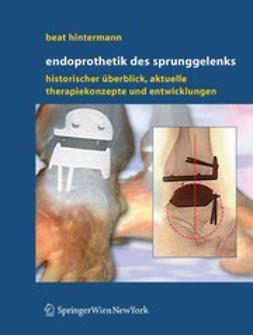 Hintermann, Beat - Endoprothetik des Sprunggelenks, ebook