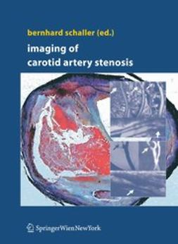 Schaller, Bernhard J. - Imaging of Carotid Artery Stenosis, ebook