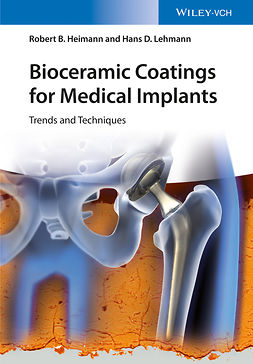 Heimann, Robert B. - Bioceramic Coatings for Medical Implants: Trends and Techniques, ebook
