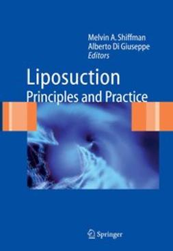 Giuseppe, Alberto - Liposuction, ebook