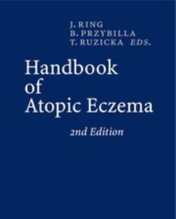 Przybilla, Bernhard - Handbook of Atopic Eczema, e-bok
