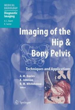 Davies, A. Mark - Imaging of the Hip & Bony Pelvis, ebook