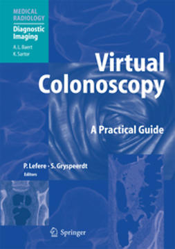 Gryspeerdt, Stefaan - Virtual Colonoscopy, ebook