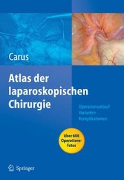 Carus, Thomas - Atlas Laparoskopische Chirurgie, ebook