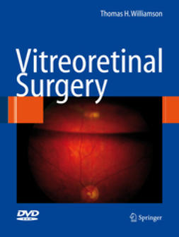 Williamson, Thomas H. - Vitreoretinal Surgery, e-bok