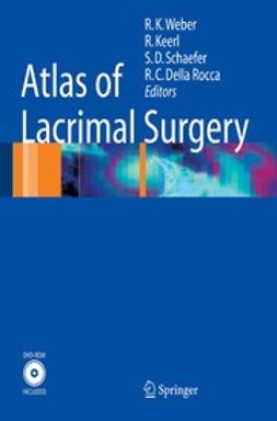 Keerl, R. - Atlas of Lacrimal Surgery, ebook