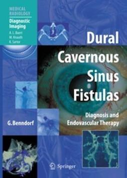 Benndorf, Goetz - Dural Cavernous Sinus Fistulas, ebook