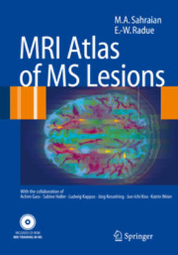 Radü, Ernst-Wilhelm - MRI Atlas of MS Lesions, e-kirja