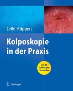 Küppers, Volkmar - Kolposkopie in der Praxis, ebook