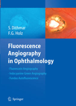 Dithmar, Stefan - Fluorescence Angiography in Ophthalmology, ebook