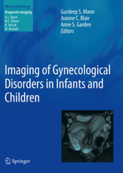 Mann, Gurdeep S. - Imaging of Gynecological Disorders in Infants and Children, e-kirja