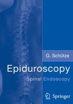 Schütze, G. - Epiduroscopy — Spinal Endoscopy, e-kirja
