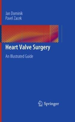 Dominik, Jan - Heart Valve Surgery, ebook