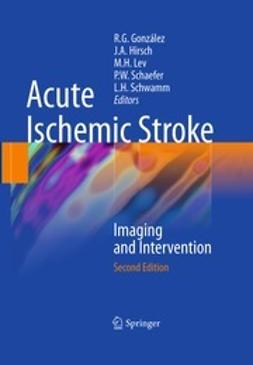 González, R. Gilberto - Acute Ischemic Stroke, ebook